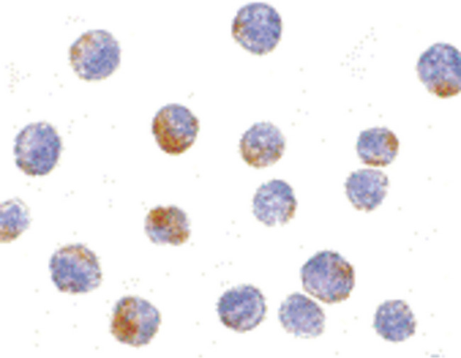 DDX3 / DDX3X Antibody - Immunocytochemistry of DDX3 in HepG2 cells with DDX3 antibody at 10 ug/ml.