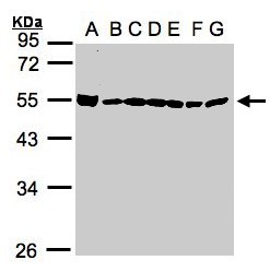 DDX39 Antibody - Sample (30g whole cell lysate). A:293T, B: A431 , C: H1299, D: HeLa S3 , E: Hep G2 . F: MOLT4 . G: Raji . 10% SDS PAGE. DDX39 / BAT1 antibody diluted at 1:1000