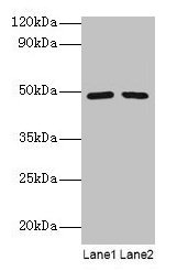 DDX39B / UAP56 Antibody - Western blot All lanes: Spliceosome RNA helicase DDX39B antibody at 2µg/ml Lane 1: EC109 whole cell lysate Lane 2: 293T whole cell lysate Secondary Goat polyclonal to rabbit IgG at 1/15000 dilution Predicted band size: 49, 51 kDa Observed band size: 49 kDa