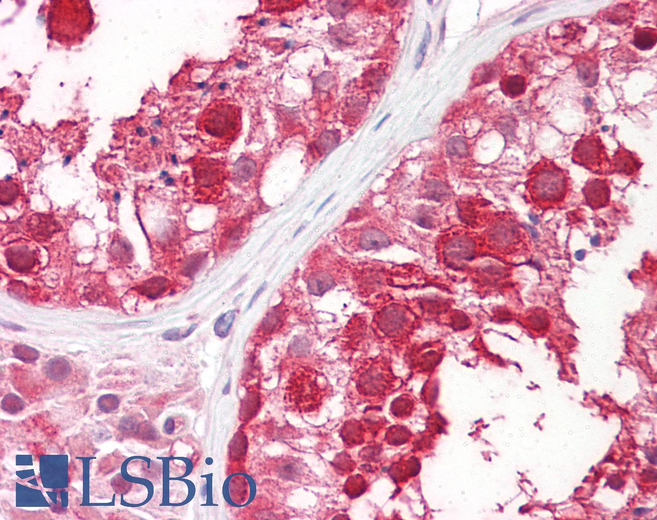 DDX4 / VASA Antibody - Anti-DDX4 antibody IHC of human testis. Immunohistochemistry of formalin-fixed, paraffin-embedded tissue after heat-induced antigen retrieval. Antibody concentration 5 ug/ml.