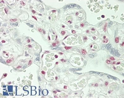 DDX5 Antibody - Human Placenta: Formalin-Fixed, Paraffin-Embedded (FFPE)
