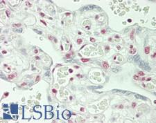 DDX5 Antibody - Human Placenta: Formalin-Fixed, Paraffin-Embedded (FFPE)