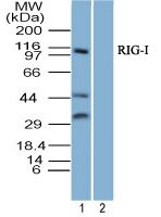 DDX58 / RIG-1 / RIG-I Antibody - Western blot of RIG-I Antibody in 293 lysate in the 1) absence and 2) presence of immunizing peptide at 3 ug/ml. Goat anti-rabbit Ig HRP secondary antibody (