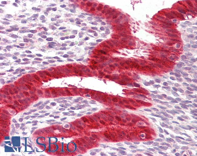 DDX58 / RIG-1 / RIG-I Antibody - Anti-RIG-1 / RIG-I antibody IHC of human uterus. Immunohistochemistry of formalin-fixed, paraffin-embedded tissue after heat-induced antigen retrieval. Antibody dilution 5-10 ug/ml.