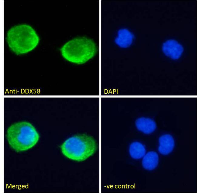 DDX58 / RIG-1 / RIG-I Antibody - DDX58 / RIG-1 / RIG-I antibody immunofluorescence analysis of paraformaldehyde fixed A431 cells, permeabilized with 0.15% Triton. Primary incubation 1hr (10ug/ml) followed by Alexa Fluor 488 secondary antibody (2ug/ml), showing cytoplasmic staining. The nuclear stain is DAPI (blue). Negative control: Unimmunized goat IgG (10ug/ml) followed by Alexa Fluor 488 secondary antibody (2ug/ml).
