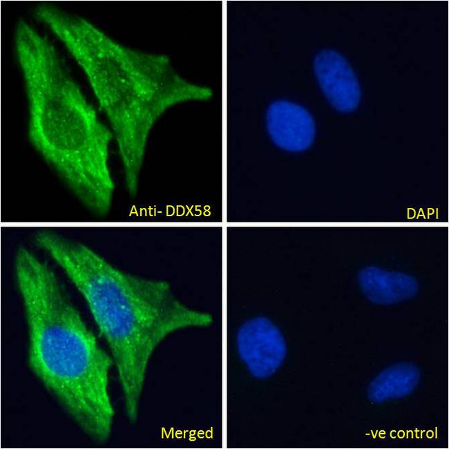 DDX58 / RIG-1 / RIG-I Antibody - DDX58 / RIG-1 / RIG-I antibody immunofluorescence analysis of paraformaldehyde fixed HeLa cells, permeabilized with 0.15% Triton. Primary incubation 1hr (10ug/ml) followed by Alexa Fluor 488 secondary antibody (2ug/ml), showing cytoplasmic staining. The nuclear stain is DAPI (blue). Negative control: Unimmunized goat IgG (10ug/ml) followed by Alexa Fluor 488 secondary antibody (2ug/ml).