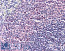 DDX58 / RIG-1 / RIG-I Antibody - Anti-DDX58 antibody IHC of human spleen. Immunohistochemistry of formalin-fixed, paraffin-embedded tissue after heat-induced antigen retrieval. Antibody concentration 3.75 ug/ml.