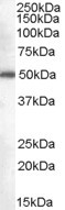 DDX6 Antibody - Antibody (0.3 ug/ml) staining of Jurkat cell lysate (35 ug protein in RIPA buffer). Primary incubation was 1 hour. Detected by chemiluminescence.