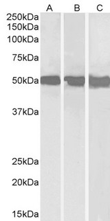 DDX6 Antibody - DEAD-box protein 6 antibody (0.3µg/ml) staining of Daudi (A), Jurkat (B) and HepG2 (C) lysates (35µg protein in RIPA buffer). Detected by chemiluminescence.