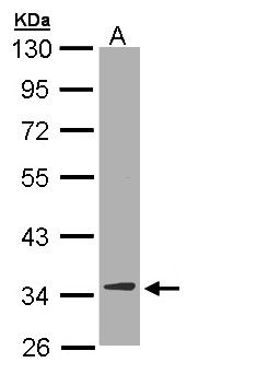 DECR1 Antibody - Sample (30 ug of whole cell lysate). A: Hep G2 . 10% SDS PAGE. DECR1 antibody diluted at 1:10000.