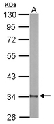 DECR1 Antibody - Sample (20 ug of whole cell lysate). A: mouse liver. 10% SDS PAGE. DECR1 antibody diluted at 1:10000.