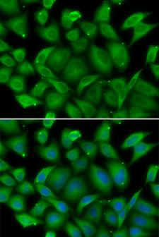 DEFA1 / Defensin Alpha 1 Antibody - Immunofluorescence analysis of HeLa cells.