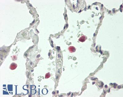 DEFB4A / BD-2 Antibody - Human Lung: Formalin-Fixed, Paraffin-Embedded (FFPE)