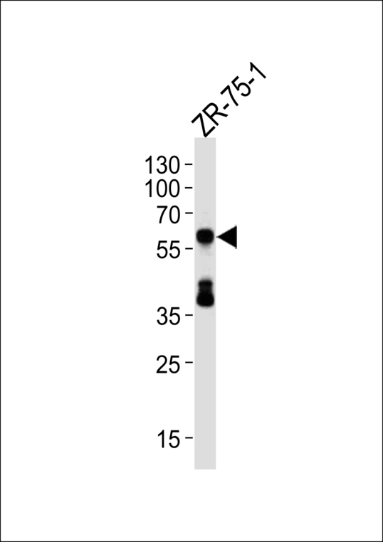 Delta3 / DLL3 Antibody - Western blot of lysate from ZR-75-1cell line, using DLL3 Antibody. Antibody was diluted at 1:1000 at each lane. A goat anti-rabbit(HRP) at 1:5000 dilution was used as the secondary antibody. Lysate at 35ug per lane.