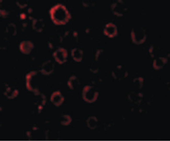 DENN / MADD Antibody - Immunofluorescence of MADD in HeLa cells with MADD antibody at 20 ug/ml.