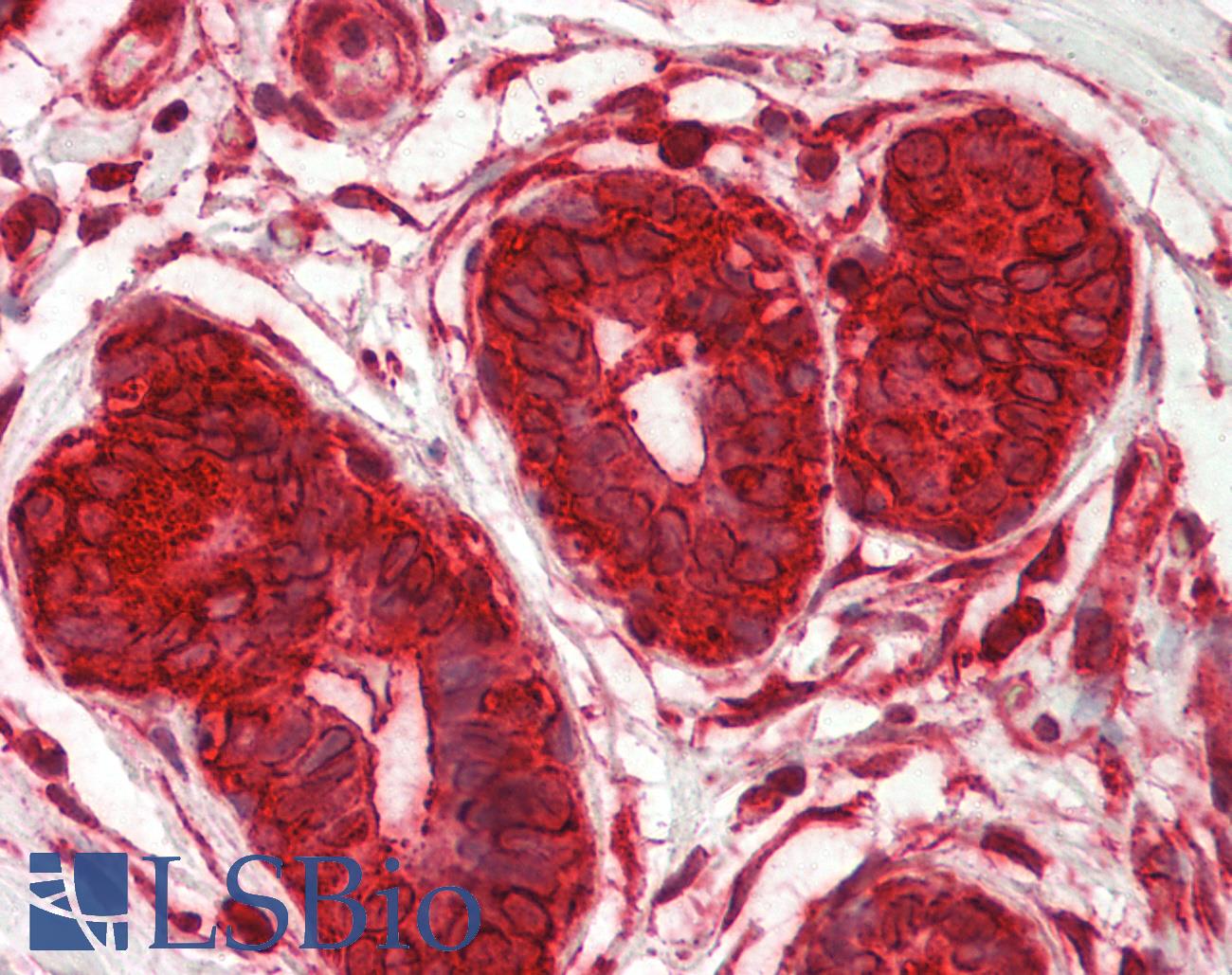 DENR / Density Regulated Antibody - Human Breast: Formalin-Fixed, Paraffin-Embedded (FFPE)