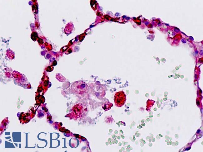 DEPDC5 Antibody - Anti-DEPDC5 antibody IHC staining of human lung, alveoli and macrophages. Immunohistochemistry of formalin-fixed, paraffin-embedded tissue after heat-induced antigen retrieval.