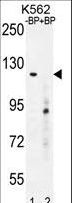 DEPDC5 Antibody - Western blot of DEPD5 Antibody antibody pre-incubated without(lane 1) and with(lane 2) blocking peptide in K562 cell line lysate. DEPD5 Antibody (arrow) was detected using the purified antibody.
