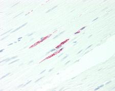 DEPTOR / DEPDC6 Antibody - Human Colon, Smooth Muscle: Formalin-Fixed, Paraffin-Embedded (FFPE)