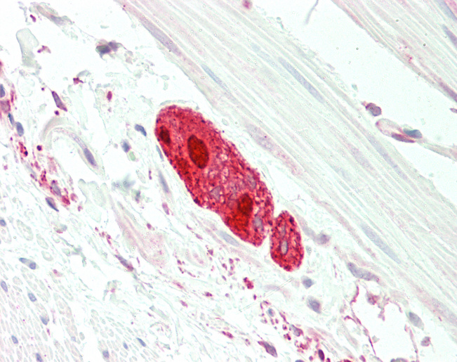 DEPTOR / DEPDC6 Antibody - Human Small Intestine, Myenteric Plexus: Formalin-Fixed, Paraffin-Embedded (FFPE)