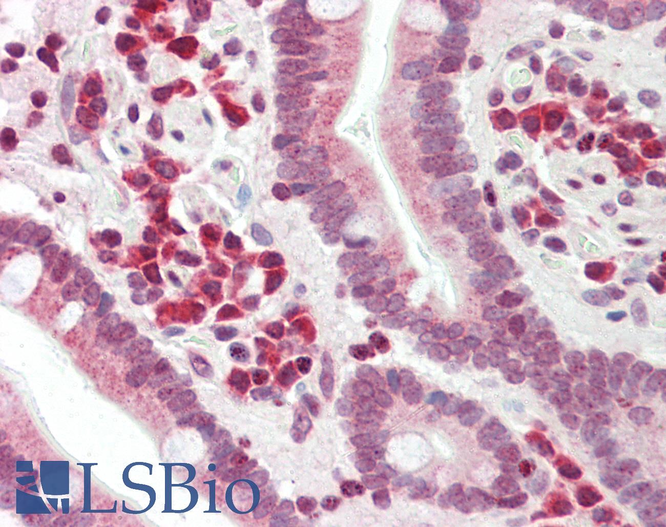 DERL1 / Derlin 1 Antibody - Anti-DERL1 / DERLIN 1 antibody IHC staining of human small intestine. Immunohistochemistry of formalin-fixed, paraffin-embedded tissue after heat-induced antigen retrieval.