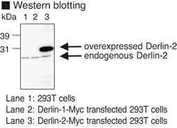DERL2 / Derlin-2 Antibody