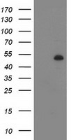 DES / Desmin Antibody - HEK293T cells were transfected with the pCMV6-ENTRY control (Left lane) or pCMV6-ENTRY DES (Right lane) cDNA for 48 hrs and lysed. Equivalent amounts of cell lysates (5 ug per lane) were separated by SDS-PAGE and immunoblotted with anti-DES.