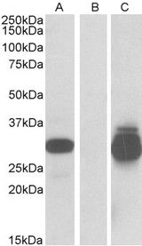 DESI2 / PPPDE1 Antibody - HEK293 lysate (10ug protein in RIPA buffer) overexpressing Human PPPDE1 with C-terminal MYC tag probed with DESI2 / PPPDE1 antibody (0.5ug/ml) in Lane A and probed with anti-MYC Tag (1/5000) in lane C. Mock-transfected HEK293 probed with DESI2 / PPPDE1 antibody (1mg/ml) in Lane B. Primary incubations were for 1 hour. Detected by chemiluminescence.