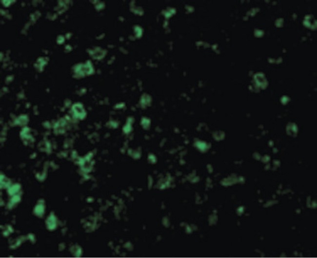 DFFA / ICAD / DFF45 Antibody - Immunofluorescence of ICAD in Mouse Lung cells with ICAD antibody at 10 ug/ml.