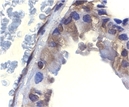 DFFA / ICAD / DFF45 Antibody - Immunohistochemistry of ICAD in murine lung tissue with ICAD antibody at 2 µg/ml.