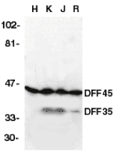 DFFA / ICAD / DFF45 Antibody - Western blot of DFF45/35 in HeLa (H), K562 (K), Jurkat (J), and Raji (R) whole cell lysate with anti-DFF45/35 (NT) at 1:1000 dilution.