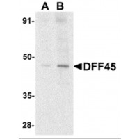 DFFA / ICAD / DFF45 Antibody - Western blot analysis of DFF45 in HeLa cell lysate with DFF45 antibody at (A) 1 and (B) 2 µg/mL.
