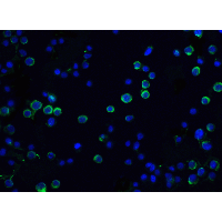 DFFA / ICAD / DFF45 Antibody - Immunofluorescence of DFF45 in Hela cells with DFF45 antibody at 20 µg/mL.Green: DFF45 Antibody  Blue: DAPI staining