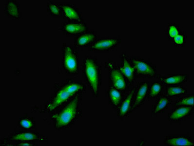 DFNA5 Antibody - Immunofluorescent analysis of Hela cells using DFNA5 Antibody at dilution of 1:100 and Alexa Fluor 488-congugated AffiniPure Goat Anti-Rabbit IgG(H+L)