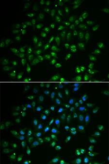 DHAND / HAND2 Antibody - Immunofluorescence analysis of A549 cell using HAND2 antibody. Blue: DAPI for nuclear staining.