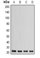 DHFR Antibody - Western blot analysis of DHFR expression in HeLa (A); HL60 (B); THP1 (C); mouse liver (D) whole cell lysates.