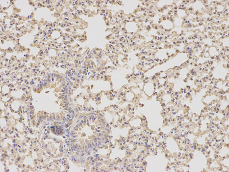 DHFR Antibody - Immunohistochemistry of paraffin-embedded mouse lung using DHFR antibody at dilution of 1:100 (200x lens).