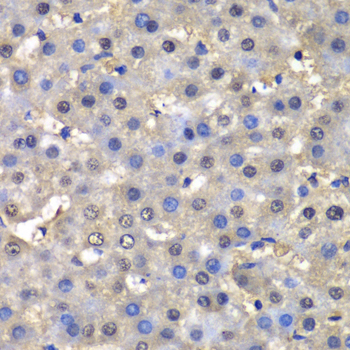 DHFR Antibody - Immunohistochemistry of paraffin-embedded human liver injury tissue.