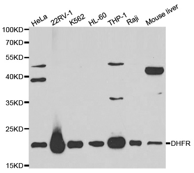 DHFR Antibody - Western blot analysis of extracts of various cell lines, using DHFR antibody at 1:1000 dilution. The secondary antibody used was an HRP Goat Anti-Rabbit IgG (H+L) at 1:10000 dilution. Lysates were loaded 25ug per lane and 3% nonfat dry milk in TBST was used for blocking.
