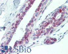 DHRS4L2 Antibody - Human Breast: Formalin-Fixed, Paraffin-Embedded (FFPE), at a concentration of 5 ug/ml. 