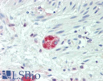 DHRS4L2 Antibody - Human Small Intestine, Submucosal Plexus: Formalin-Fixed, Paraffin-Embedded (FFPE), at a concentration of 5 ug/ml. 