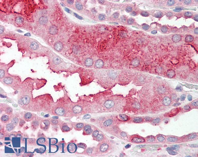 DHRS7 Antibody - Anti-DHRS7 antibody IHC of human kidney. Immunohistochemistry of formalin-fixed, paraffin-embedded tissue after heat-induced antigen retrieval.