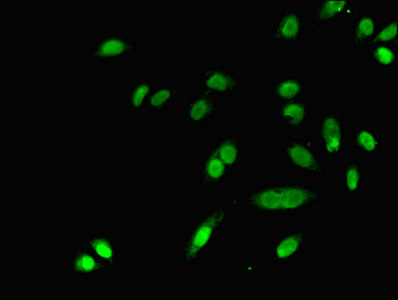 DHRS9 Antibody - Immunofluorescent analysis of A549 cells using DHRS9 Antibody at dilution of 1:100 and Alexa Fluor 488-congugated AffiniPure Goat Anti-Rabbit IgG(H+L)
