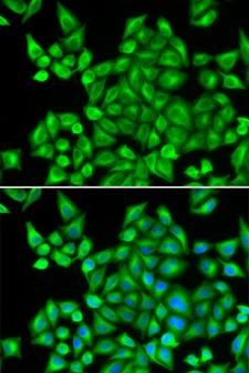 DHRS9 Antibody - Immunofluorescence analysis of HeLa cells.