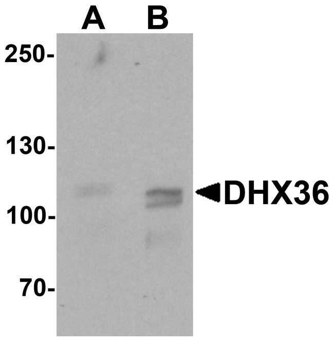 DHX36 Antibody - Western blot analysis of DHX36 in mouse liver tissue lysate with DHX36 antibody at (A) 0.5 and (B) 1 ug/ml.