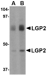 DHX58 / LGP2 Antibody - Western blot of LGP2 in rat kidney tissue lysate with LGP2 antibody at (A) 1 and (B) 2 ug/ml.