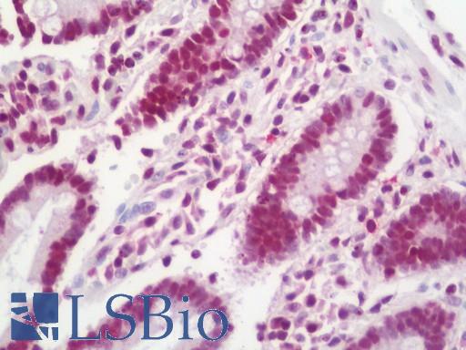 DHX8 Antibody - Anti-DHX8 antibody IHC staining of human small intestine. Immunohistochemistry of formalin-fixed, paraffin-embedded tissue after heat-induced antigen retrieval. Antibody dilution 1:100.