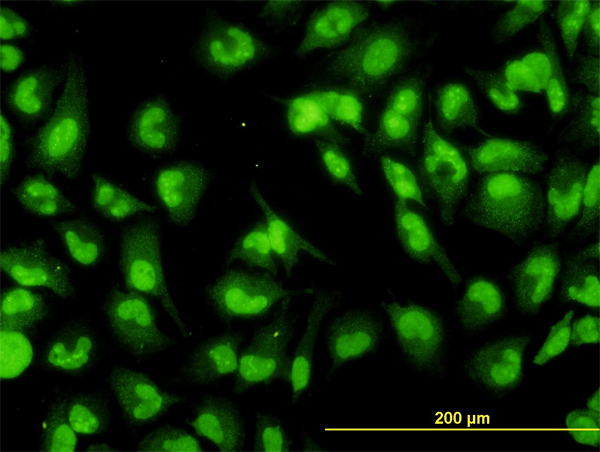 DHX9 Antibody - Immunofluorescence of monoclonal antibody to DHX9 on HeLa cell. [antibody concentration 10 ug/ml]