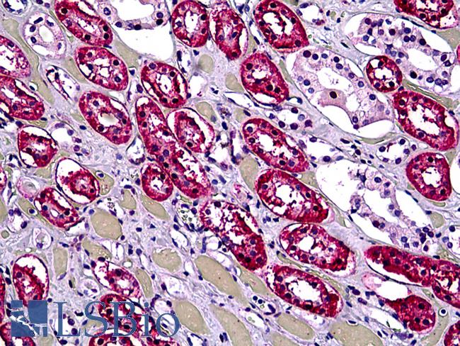 DHX9 Antibody - Anti-DHX9 antibody IHC of human kidney, tubules. Immunohistochemistry of formalin-fixed, paraffin-embedded tissue after heat-induced antigen retrieval. Antibody concentration 5 ug/ml.