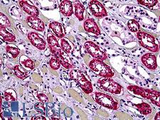DHX9 Antibody - Anti-DHX9 antibody IHC of human kidney, tubules. Immunohistochemistry of formalin-fixed, paraffin-embedded tissue after heat-induced antigen retrieval. Antibody concentration 5 ug/ml.